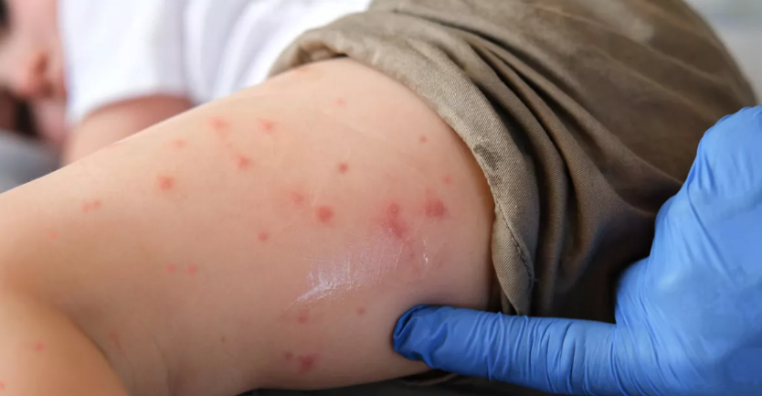 imagen_2026-03-15_142936808