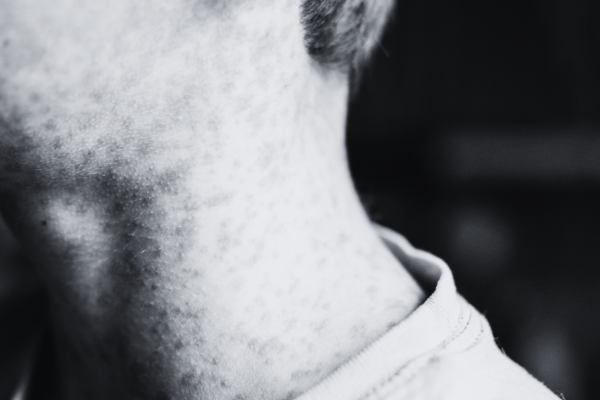 Galería de 2 imágenes (1)