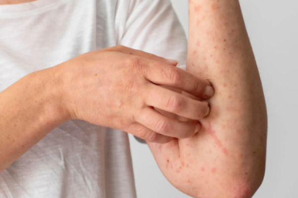 imagen_2026-03-05_160821641